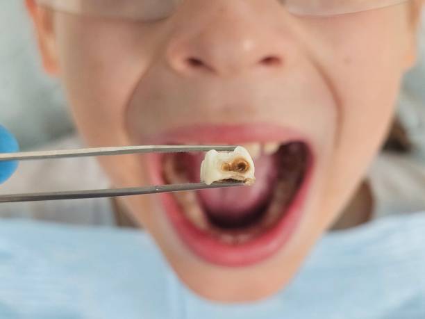 Best Emergency Treatment for Oral Infections in Italy, TX